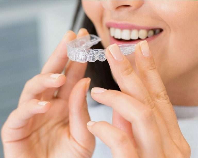 Pasadena ivisalign and teeth whitening Pasadena CA