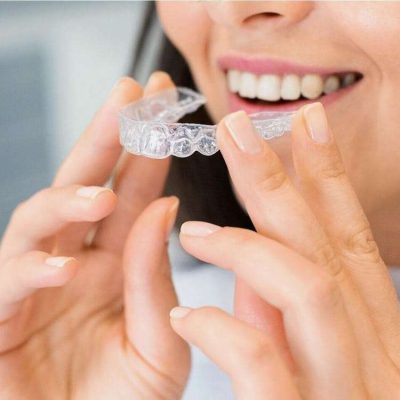 Pasadena ivisalign and teeth whitening Pasadena CA